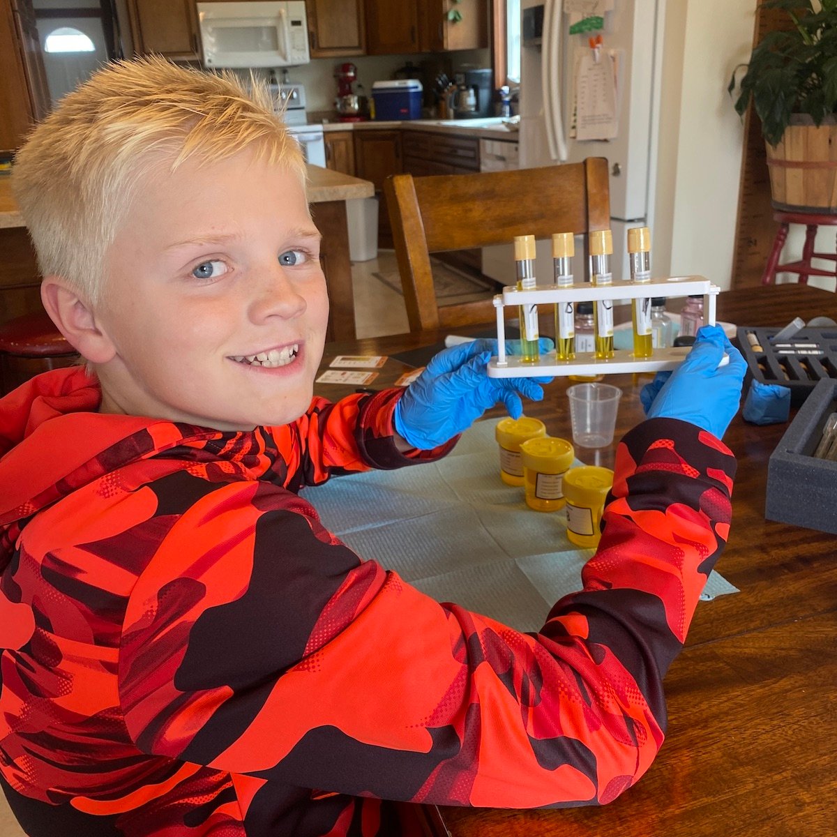 Becca's son performing tests on color and turbidity for his urinalysis project from MEL Medicine.