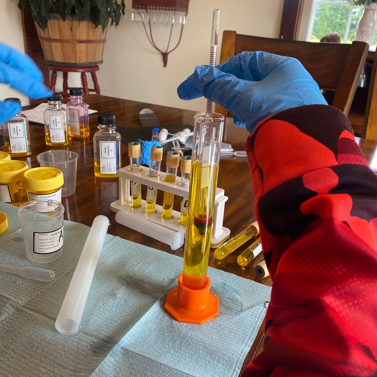 Becca's son tested his urine density with a hydrometer for his MEL Medicine project.
